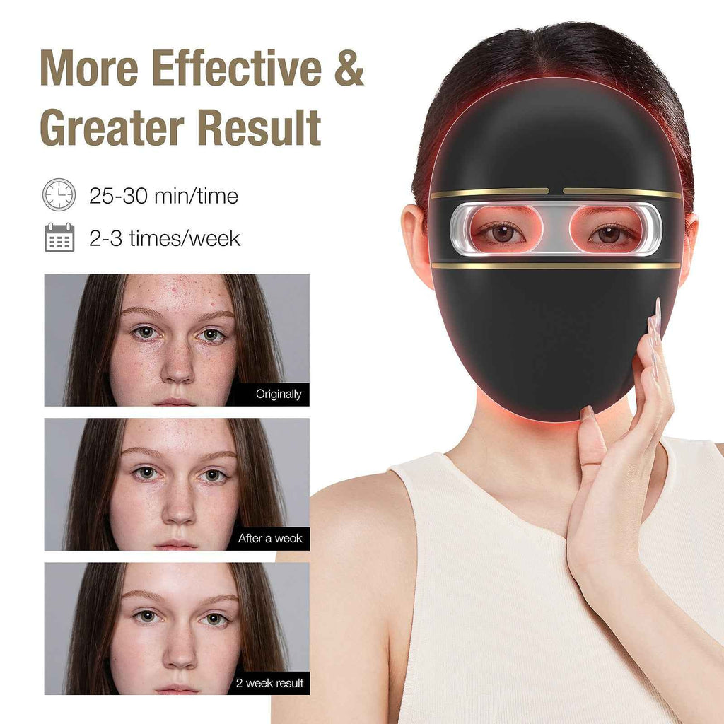 LED Spectrum Beauty Mask – Photon Therapy & Hot Compress