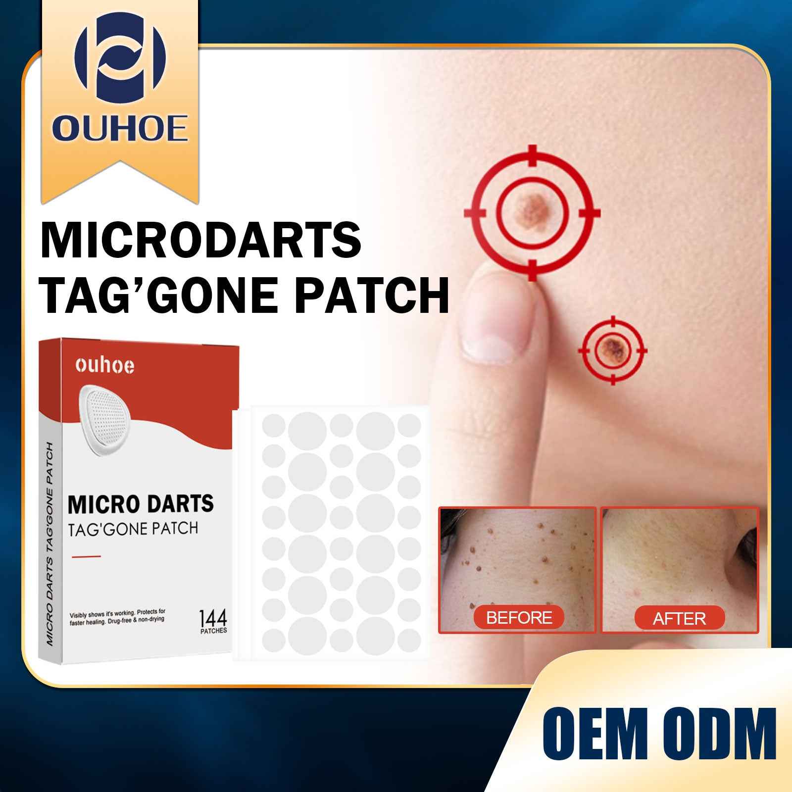 Purifying Face Patches – 144 pcs