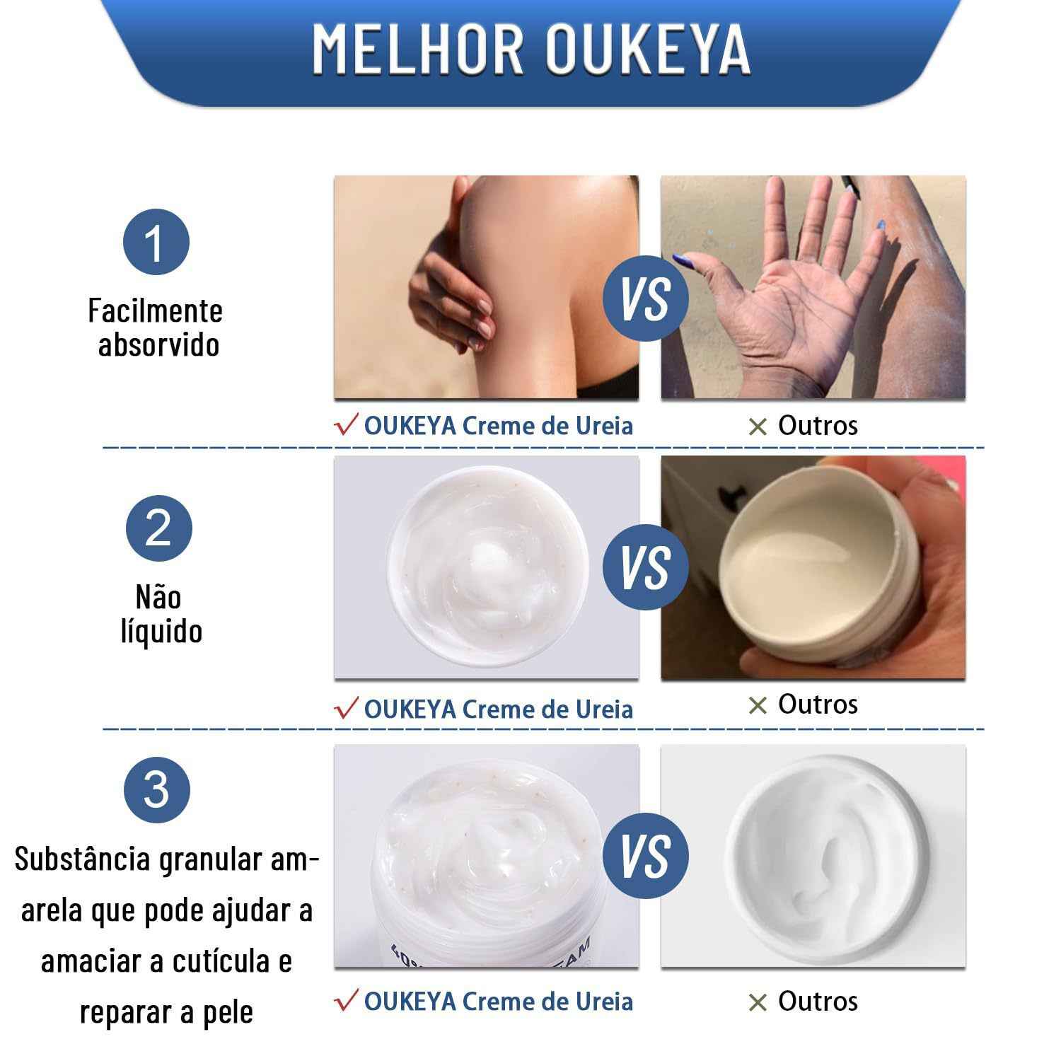 Urea Body Cream – Intense Hydration & Dry Skin Relief 150ml